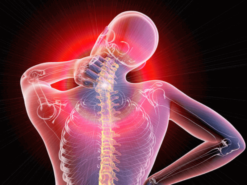 TURTLE NECK SYNDROME